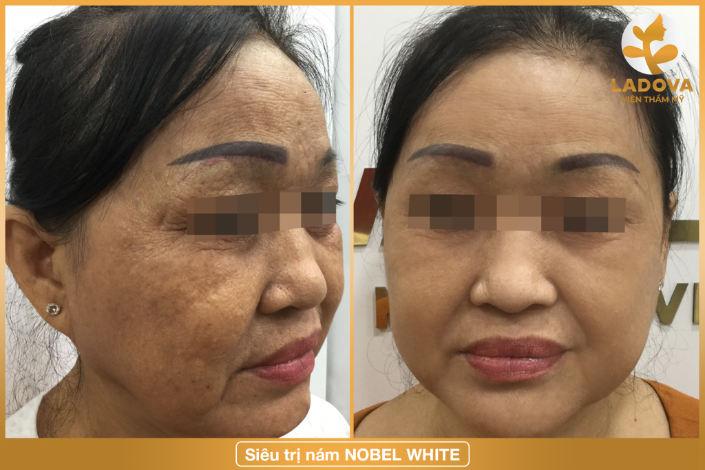 trị-nam-da-tphcm