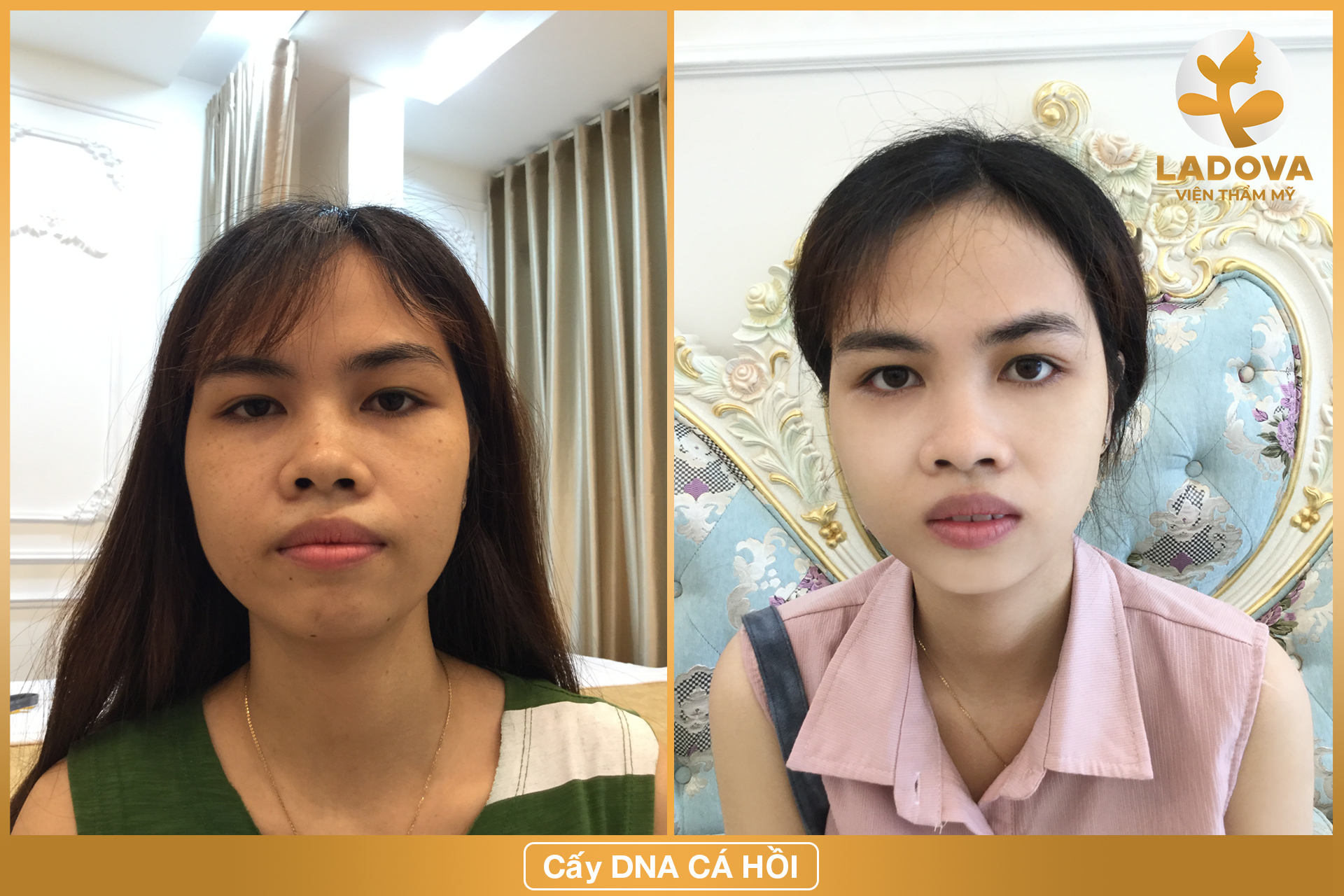 tre-hoa-da-voi-dna-ca-hoi