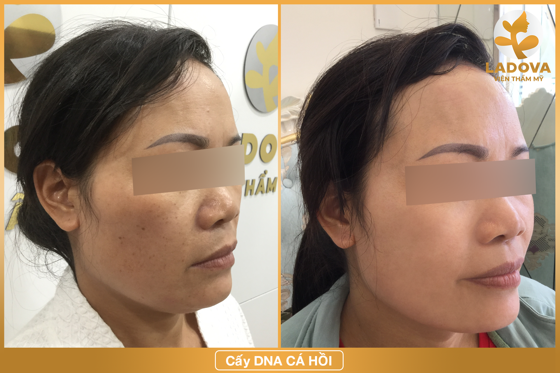 cay-dna-ca-hoi