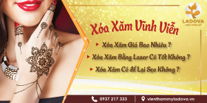 xoa-hinh-xam-gia-bao-nhieu-tien
