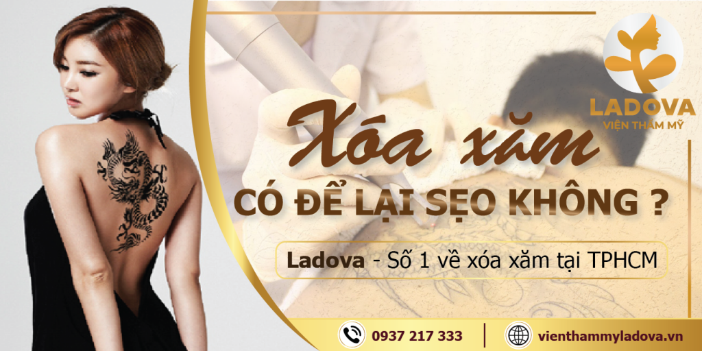 xoa-hinh-xam