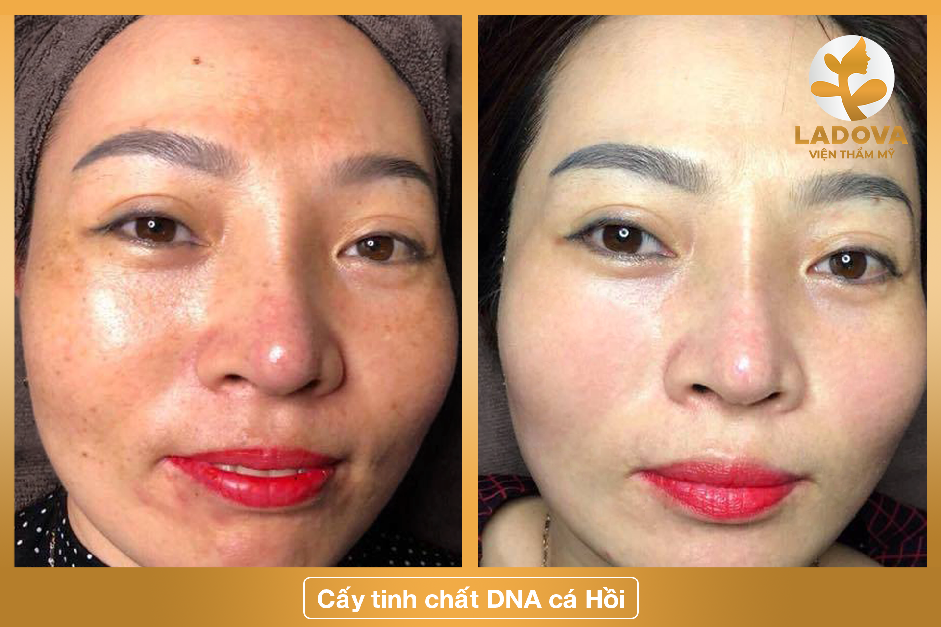 cay-tinh-chat-tre-hoa-da