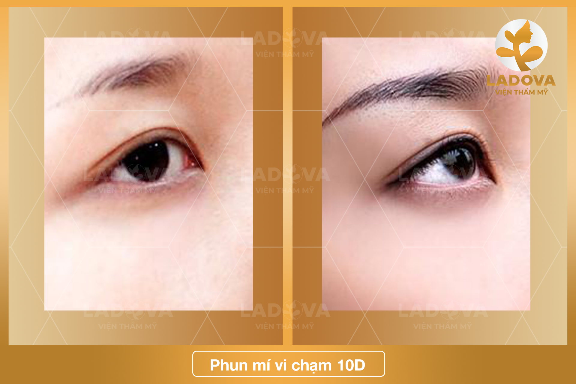 phun-mi-vi-cham-10d-ladova
