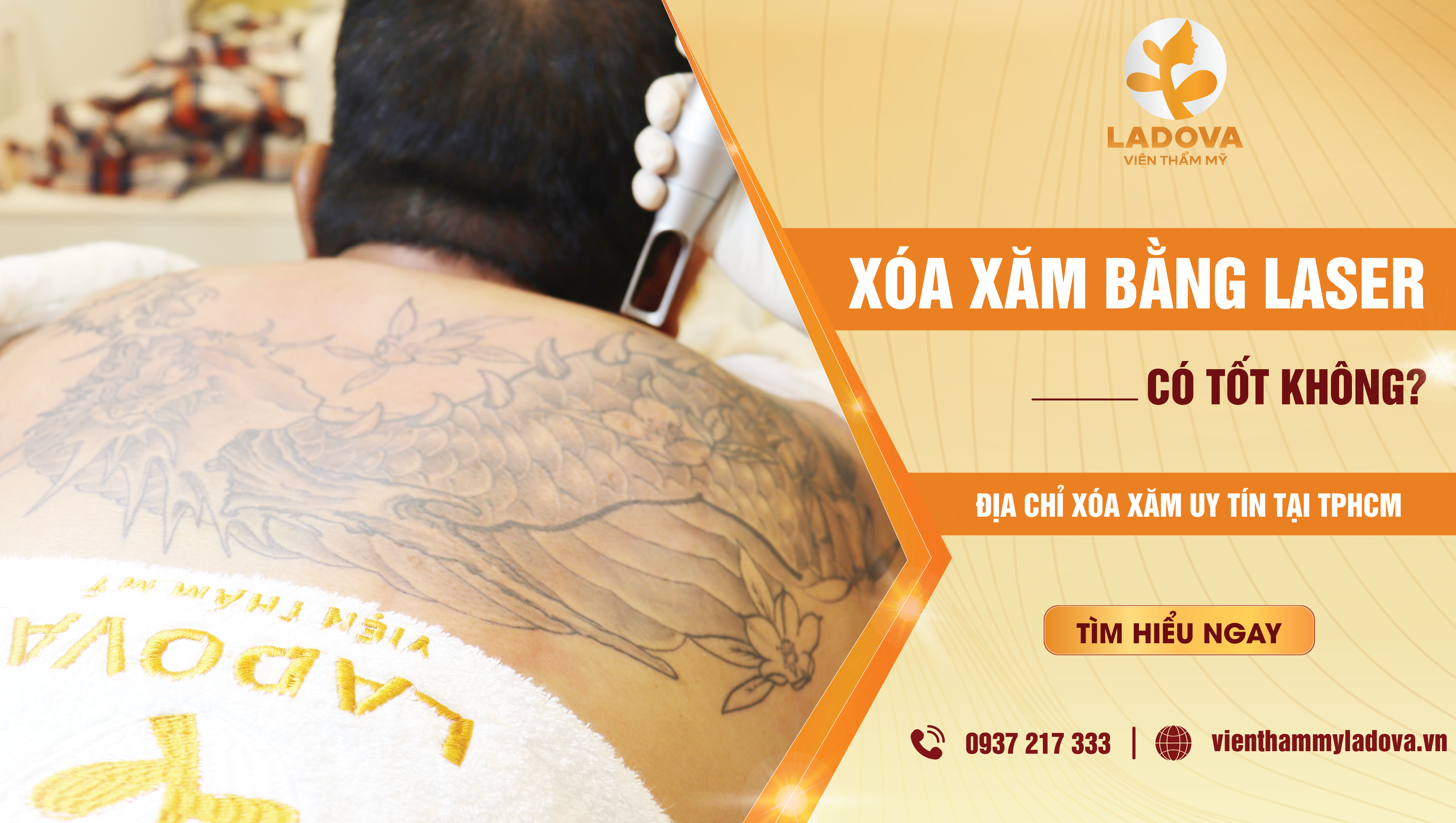 xoa-xam-bang-laser-co-tot-khong