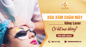 XOA-XAM-CHAN-MAY-BANG-LASER