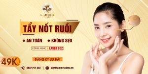 xoa-not-ruoi-tphcm