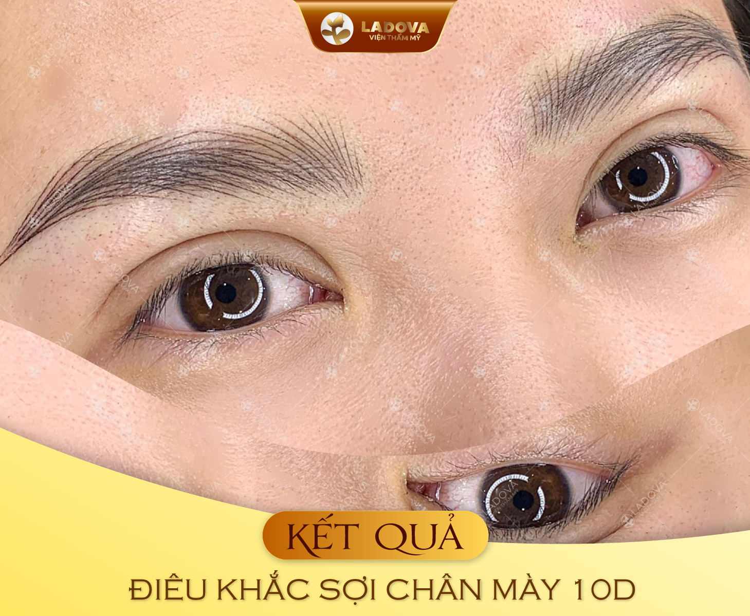 DIEU-KHAC-CHAN-MAY