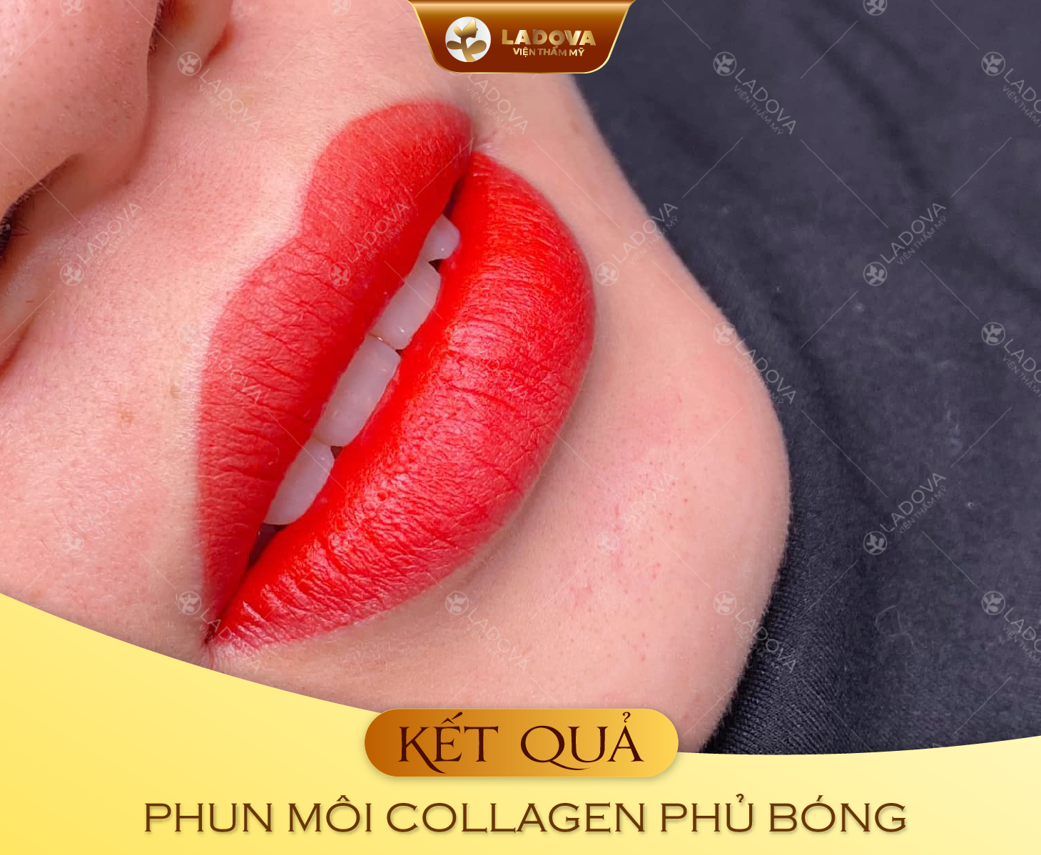 PHUN-MOI-COLLAGEN