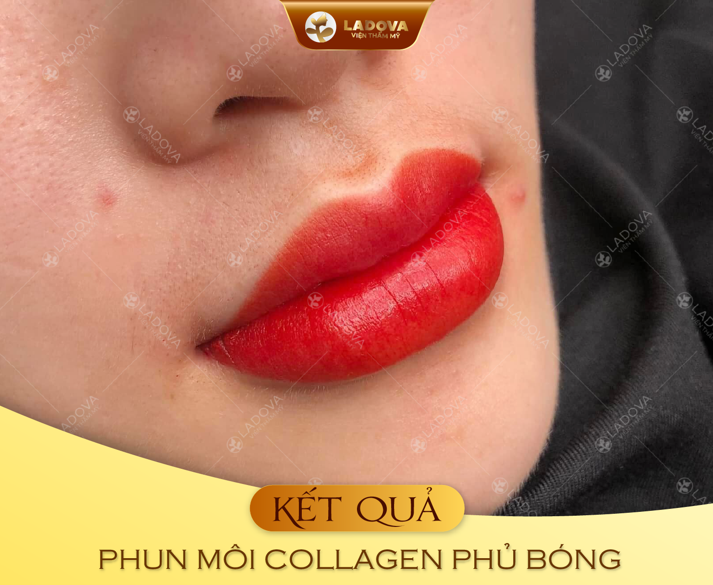 PHUN-MOI-TPHCM