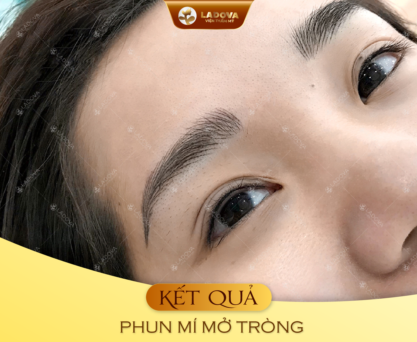 phun-mi-mo-trong-hcm