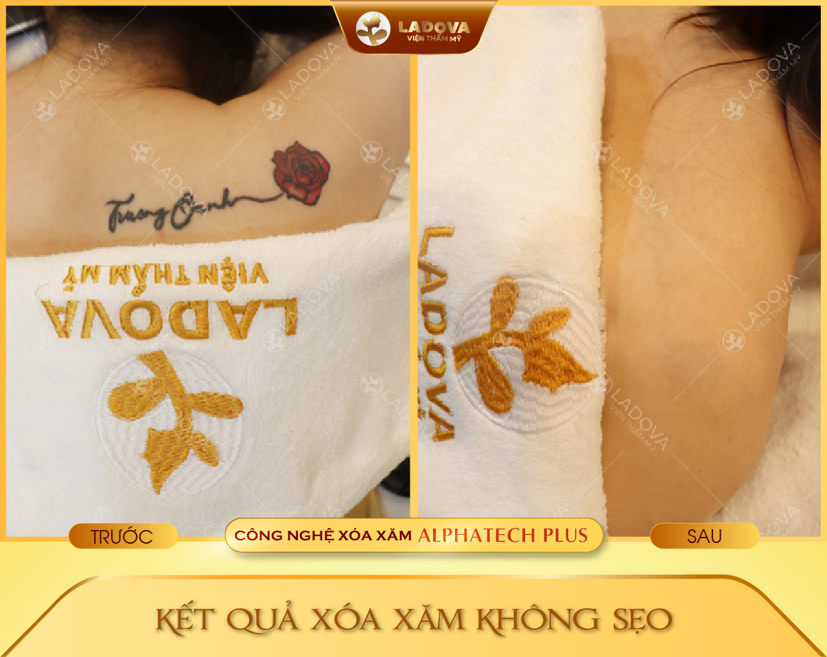 XOA-XAM-BONG-HOA-01