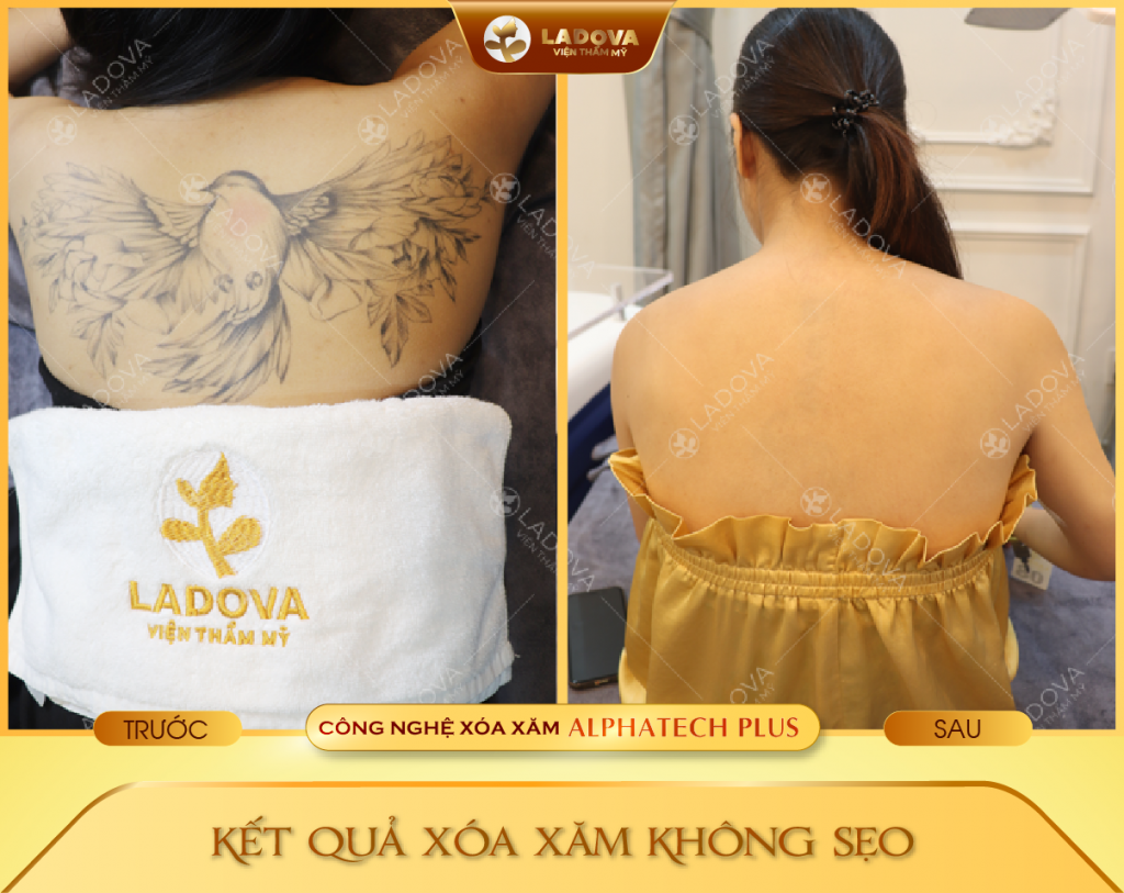 XOA-XAM-O-LUNG-01