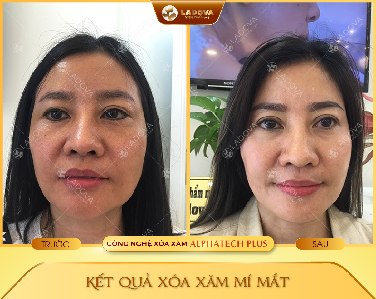 XOA-XAM-MI-MAT-01