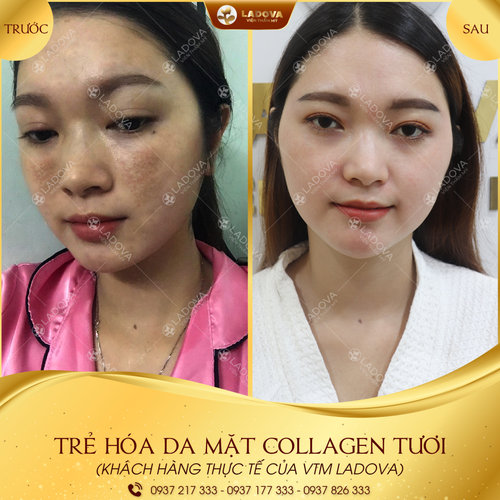 CAY-COLLAGEN-TUOI-01