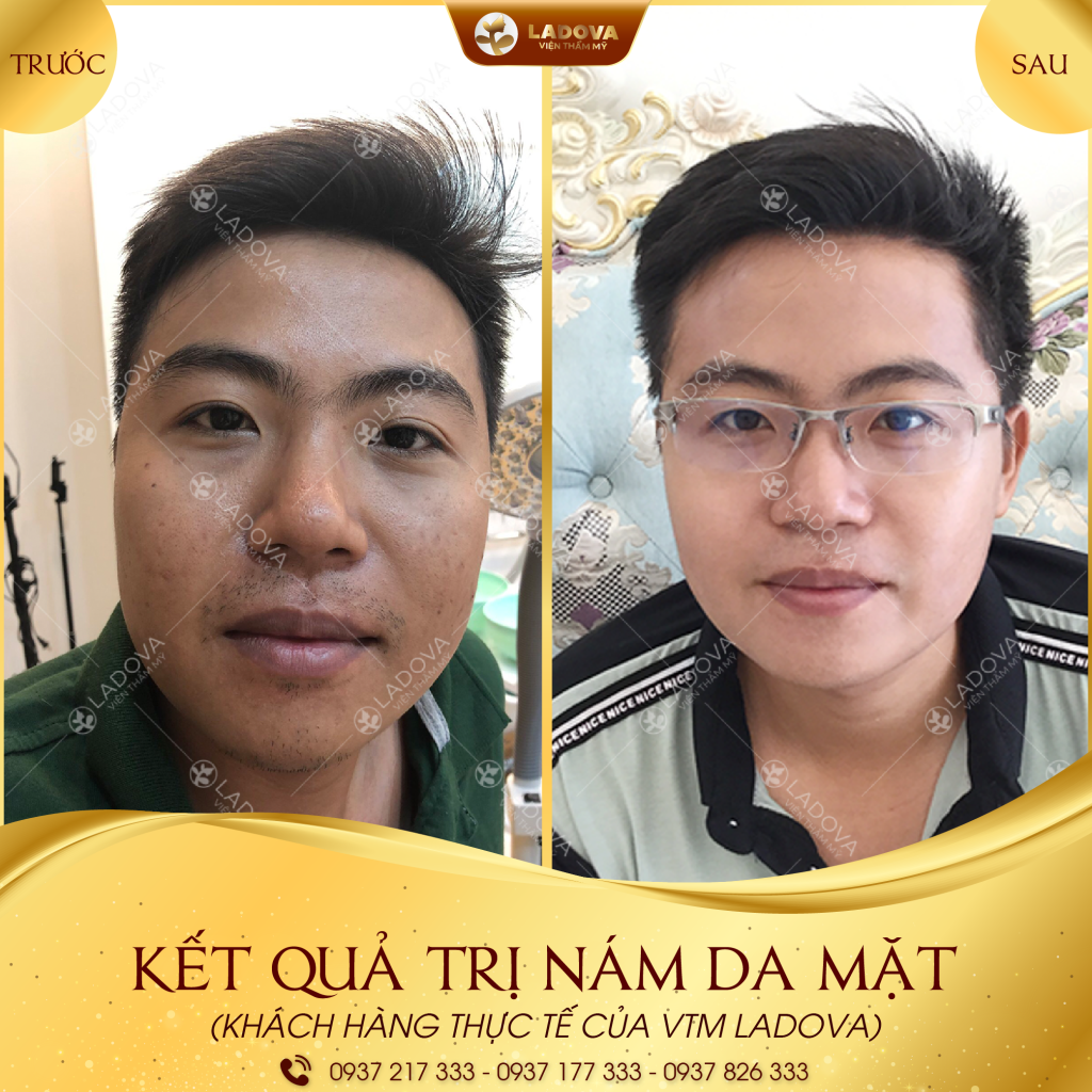 CHUA-NAM-DA-MMAT-01