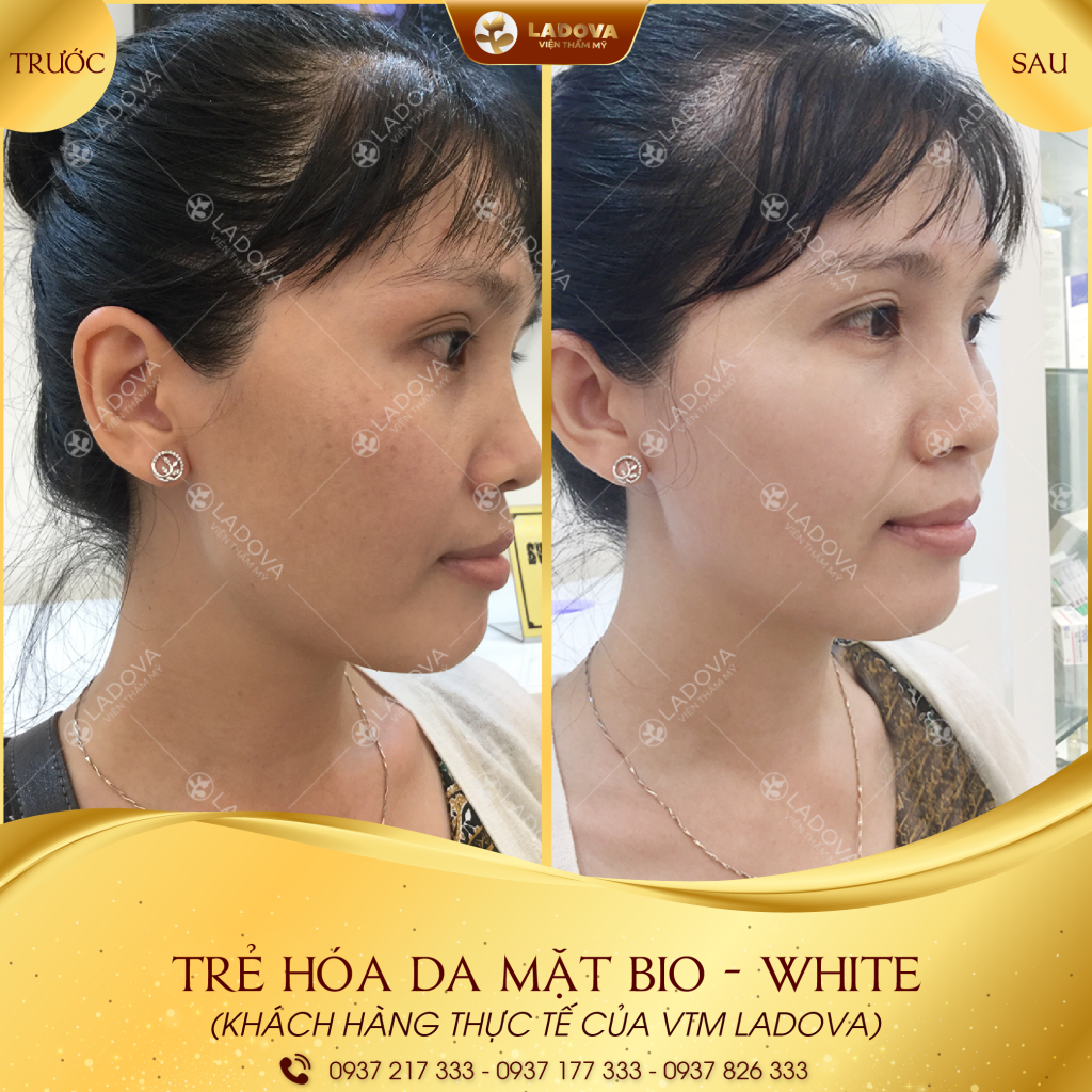 LAM-DEP-DA-MAT-LADOVA-01-01