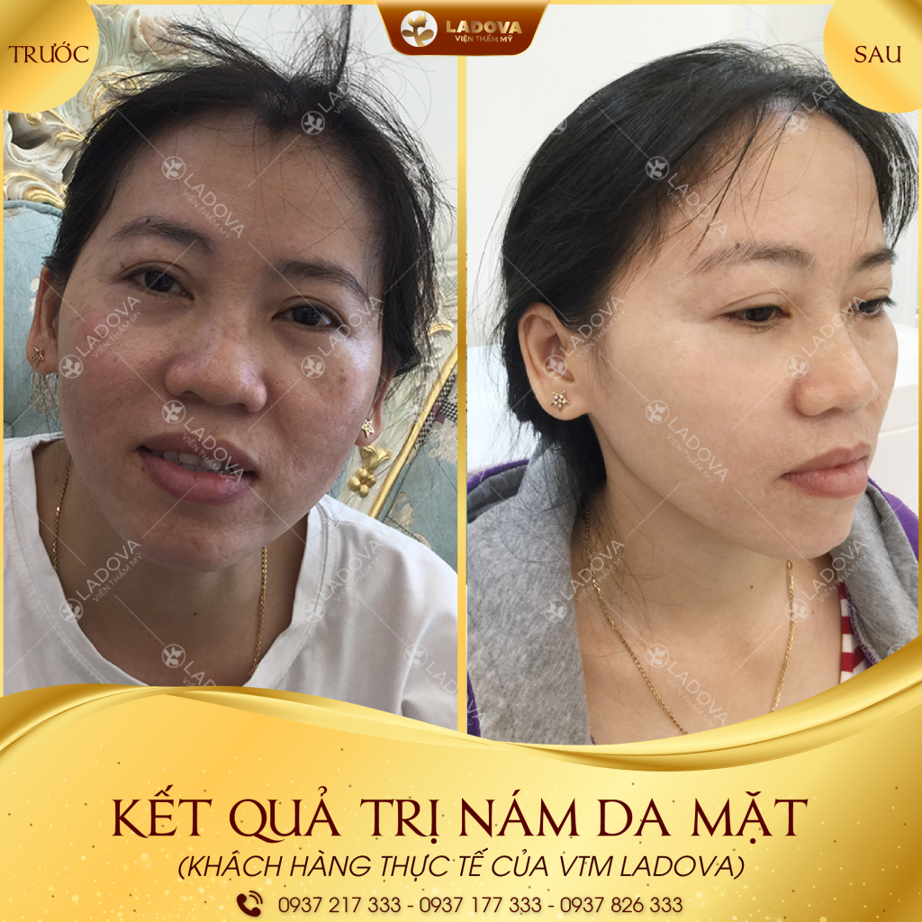 NAM-DA-MAT-01