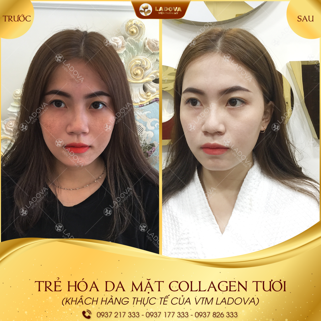 TRE-HOA-DA-MAT-CANG-BONG-01