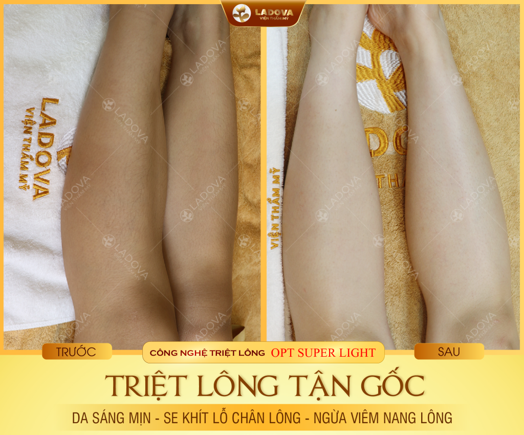 triet-long-chan-hieu-qua-01