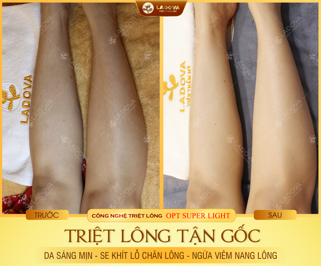 triet-long-chan-vinh-vien-01