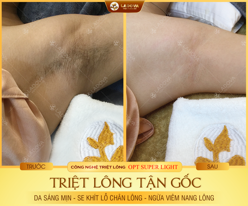 triet-long-nach-vinh-vien-01