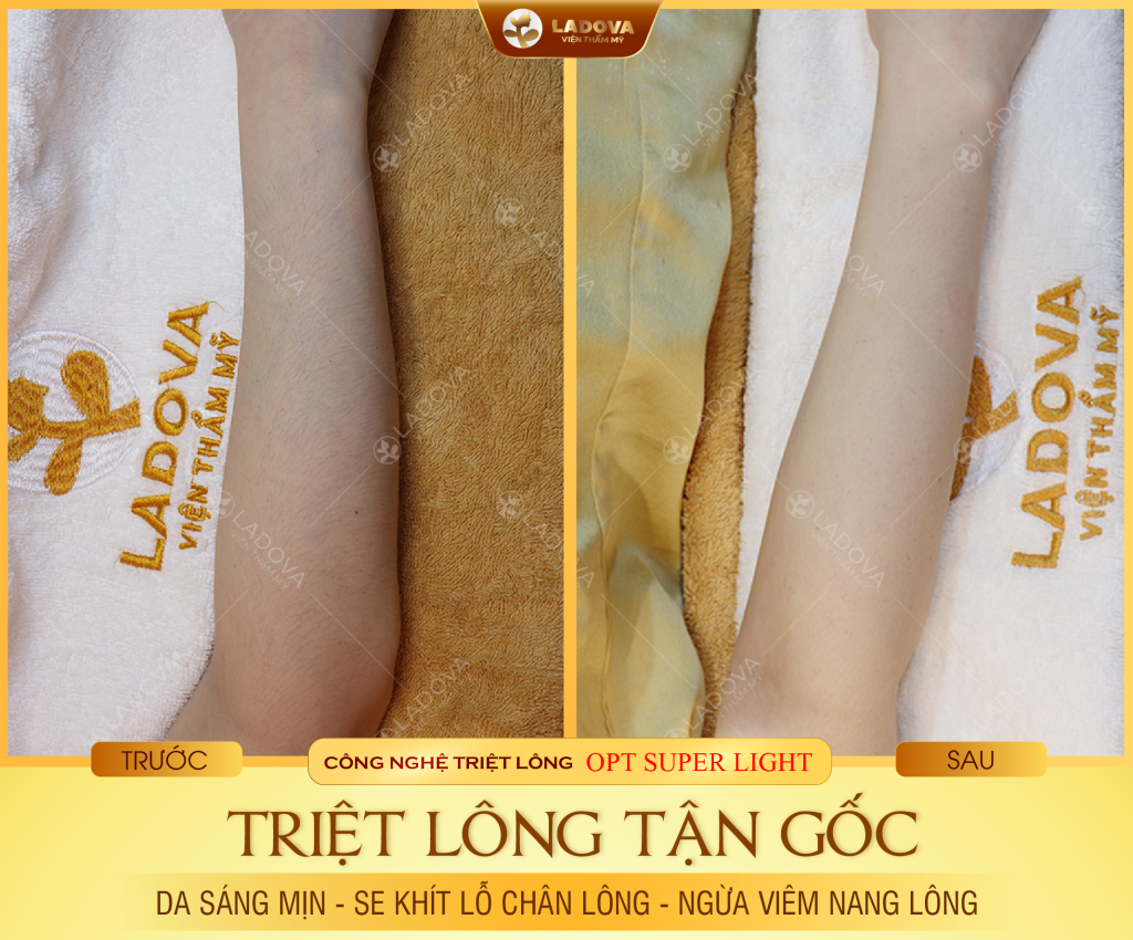 triet-long-tay-2-01