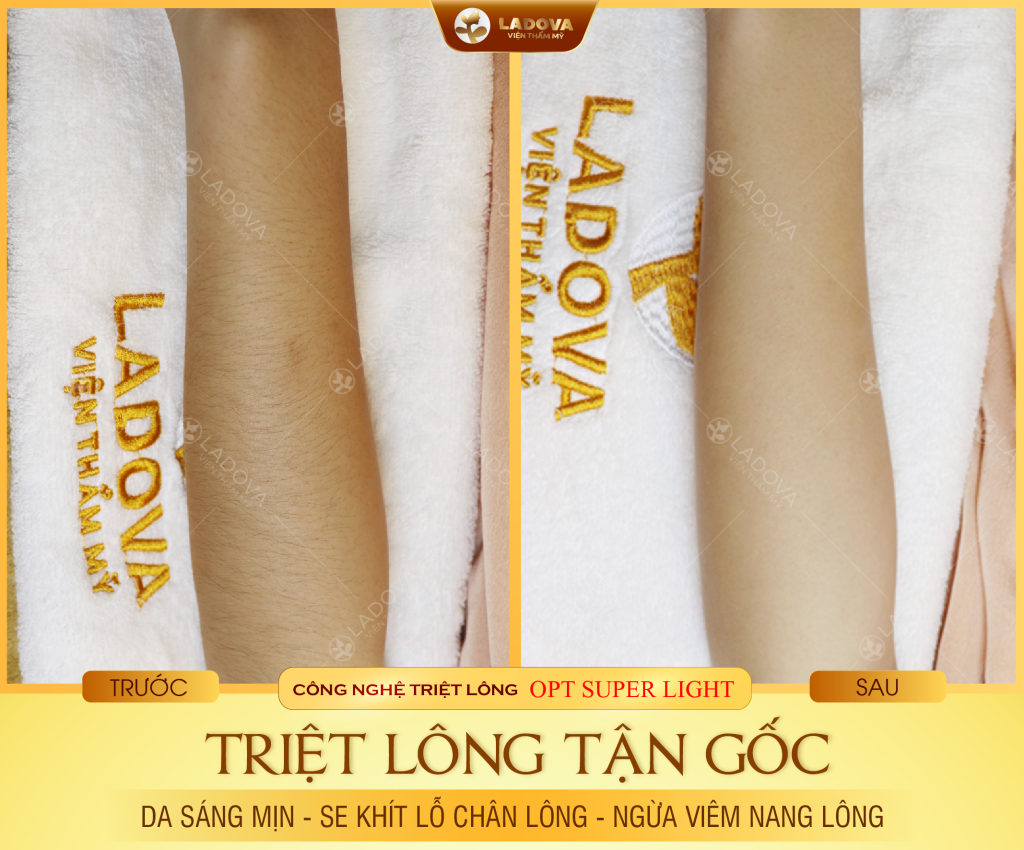 triet-long-tay-hieu-qua-1-01