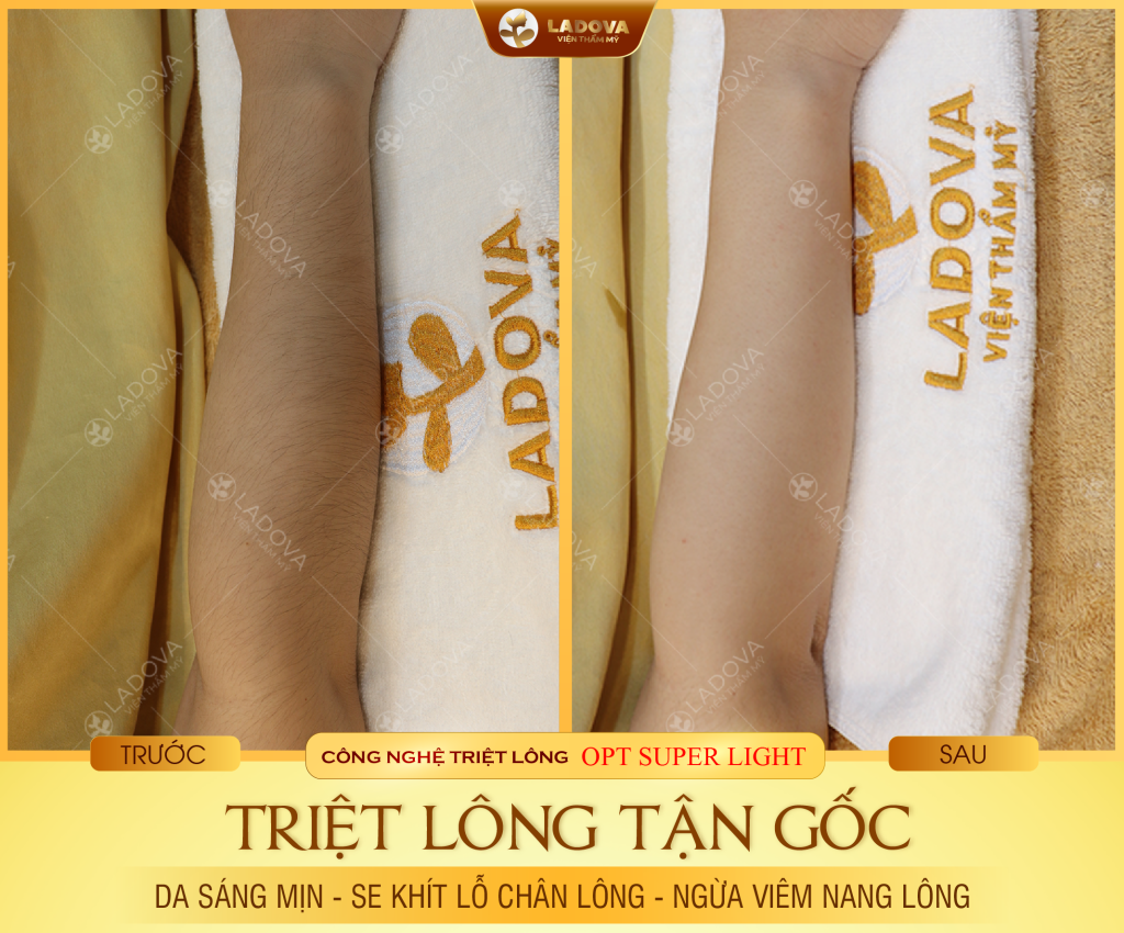 triet-long-tay-vinh-vien-01