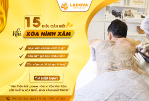15-dieu-can-biet-khi-xoa-hinh-xam-01