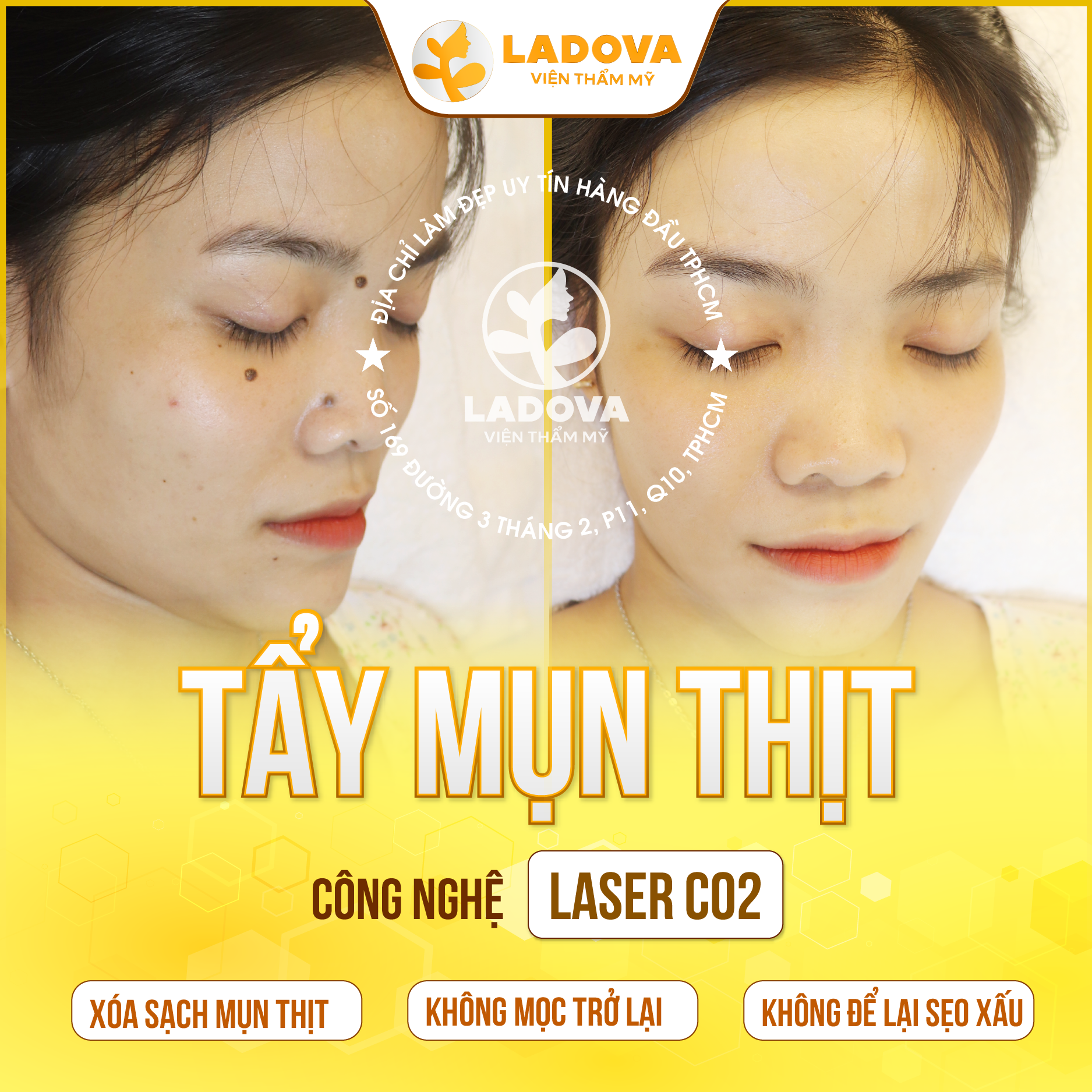 DOT-MUN-THIT-QUANH-MAT-01