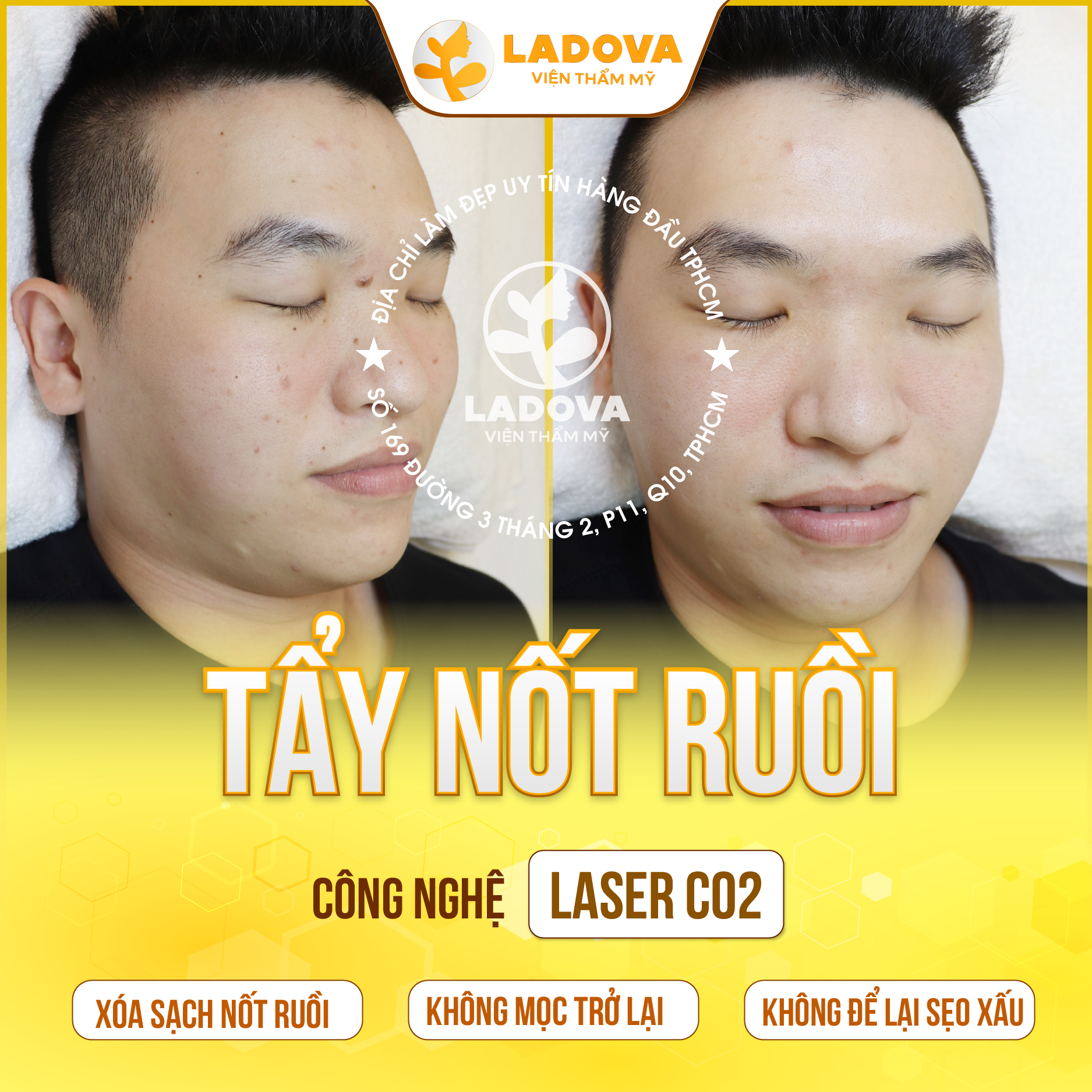 TAY-MUN-RUOI-O-DAU-01