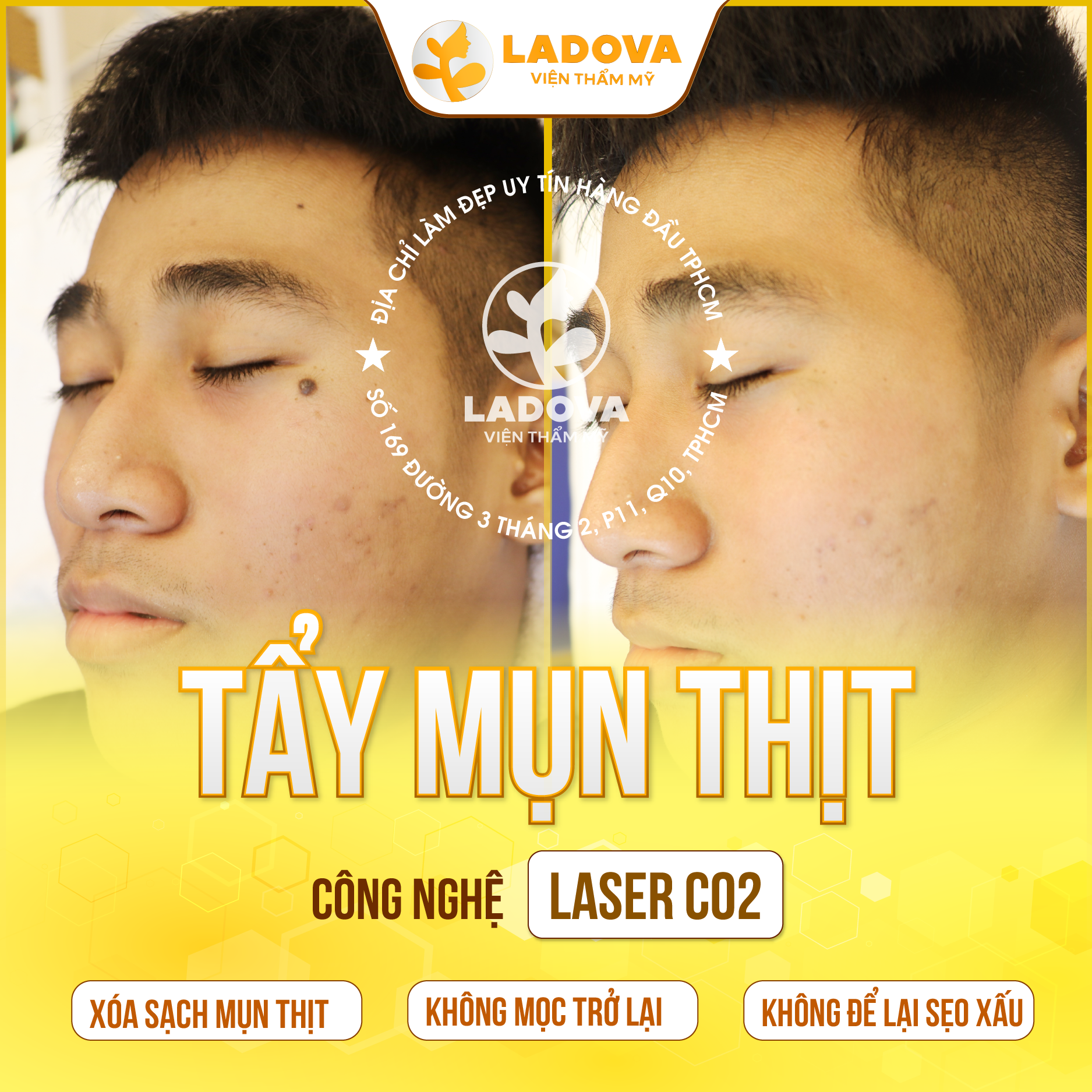 TAY-MUN-THIT-K-SEO-01