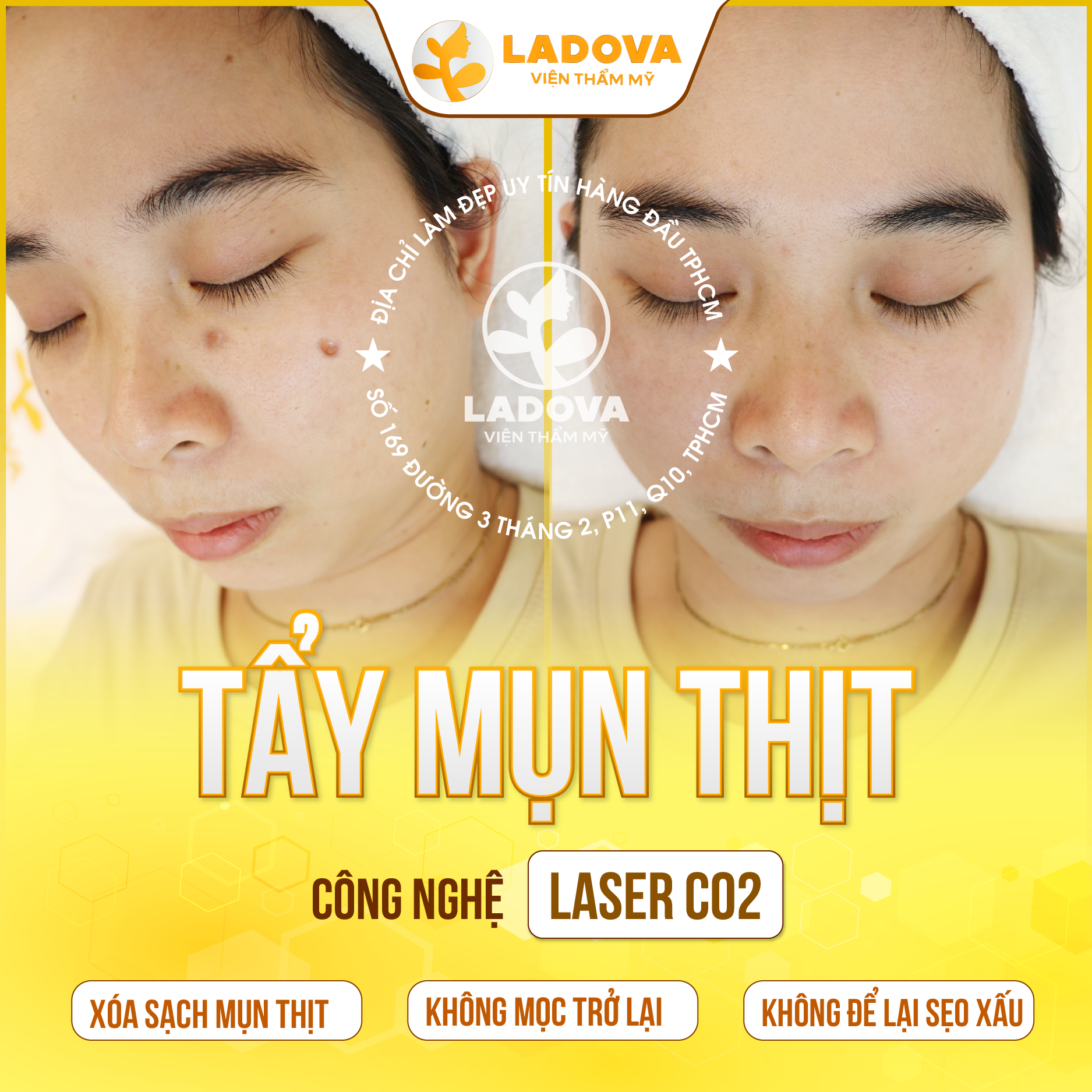 TAY-MUN-THIT-O-DAU-01