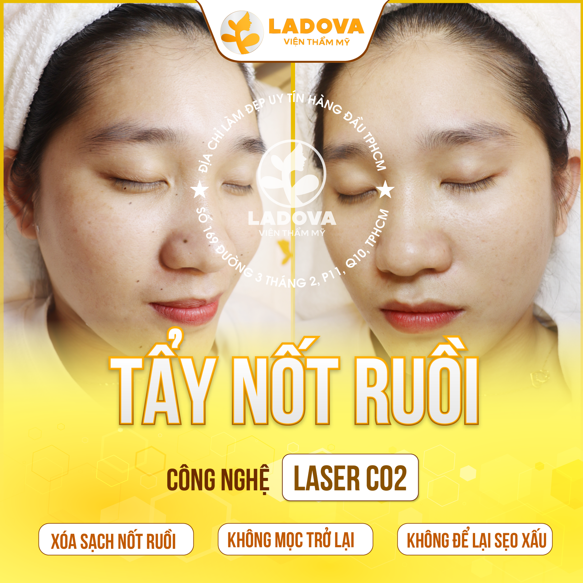 TAY-NOT-RUOI-UY-TIN-TPHCM-01