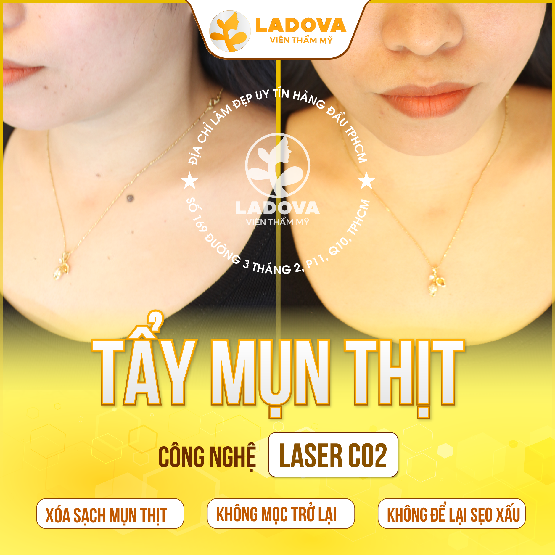 TRI-MUN-THIT-O-CO-01
