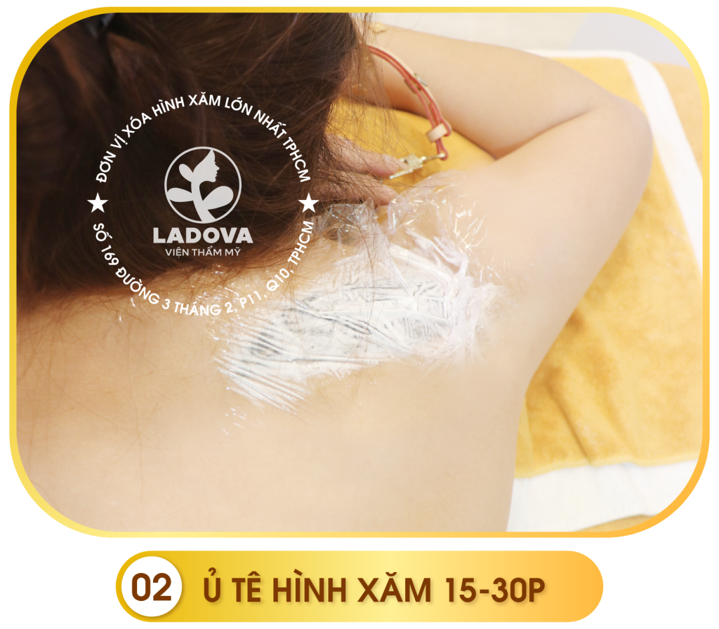 quy-trinh-xoa-hinh-xam-ladova-02