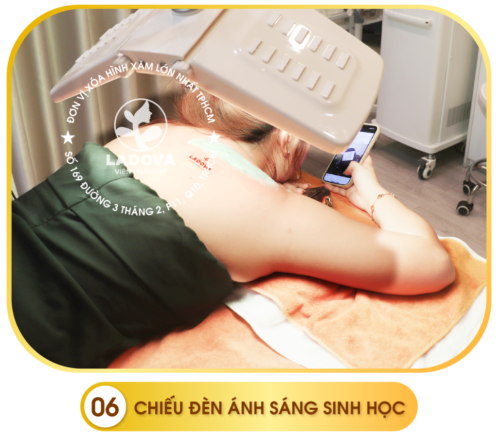quy-trinh-xoa-hinh-xam-ladova-06