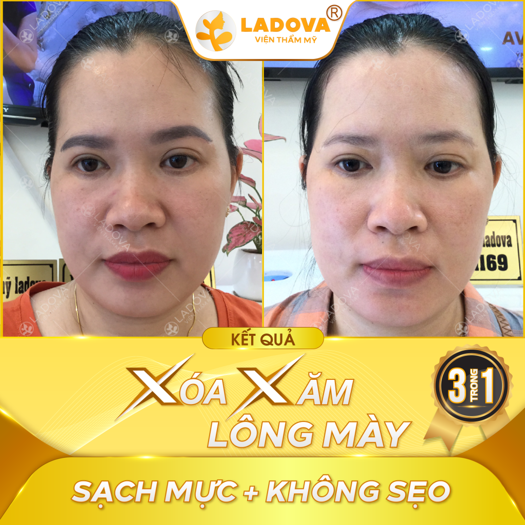spa-xoa-xam-chan-may-01