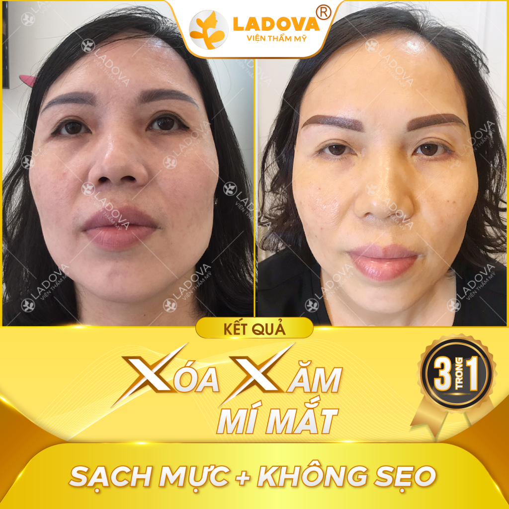 spa-xoa-xam-mi-mat-01