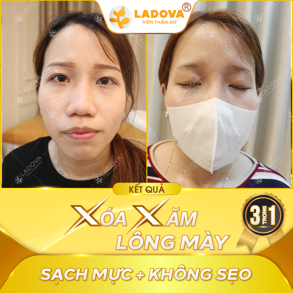 xoa-xam-chan-may-tro-do-01