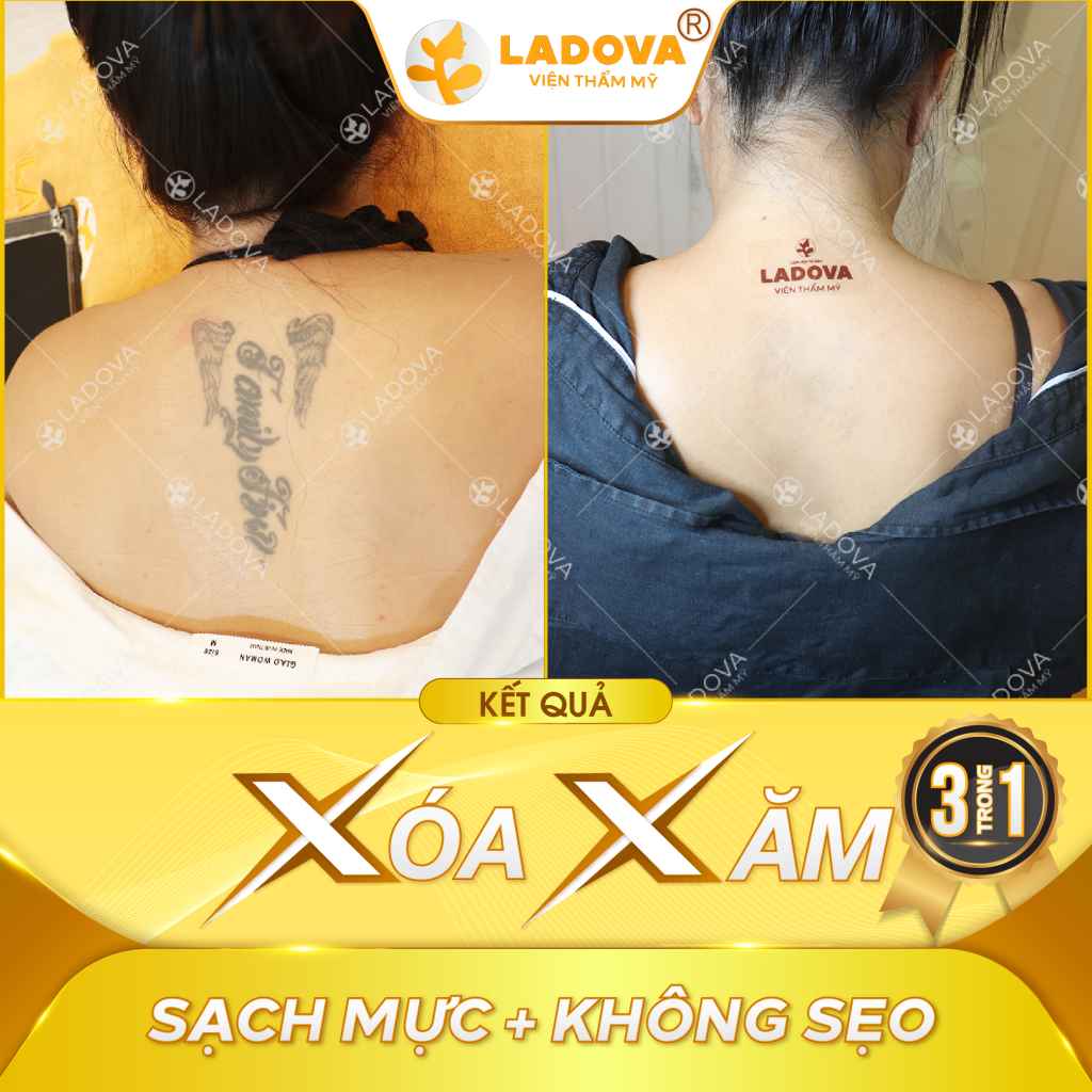 xoa-xam-chu-sau-lung-01