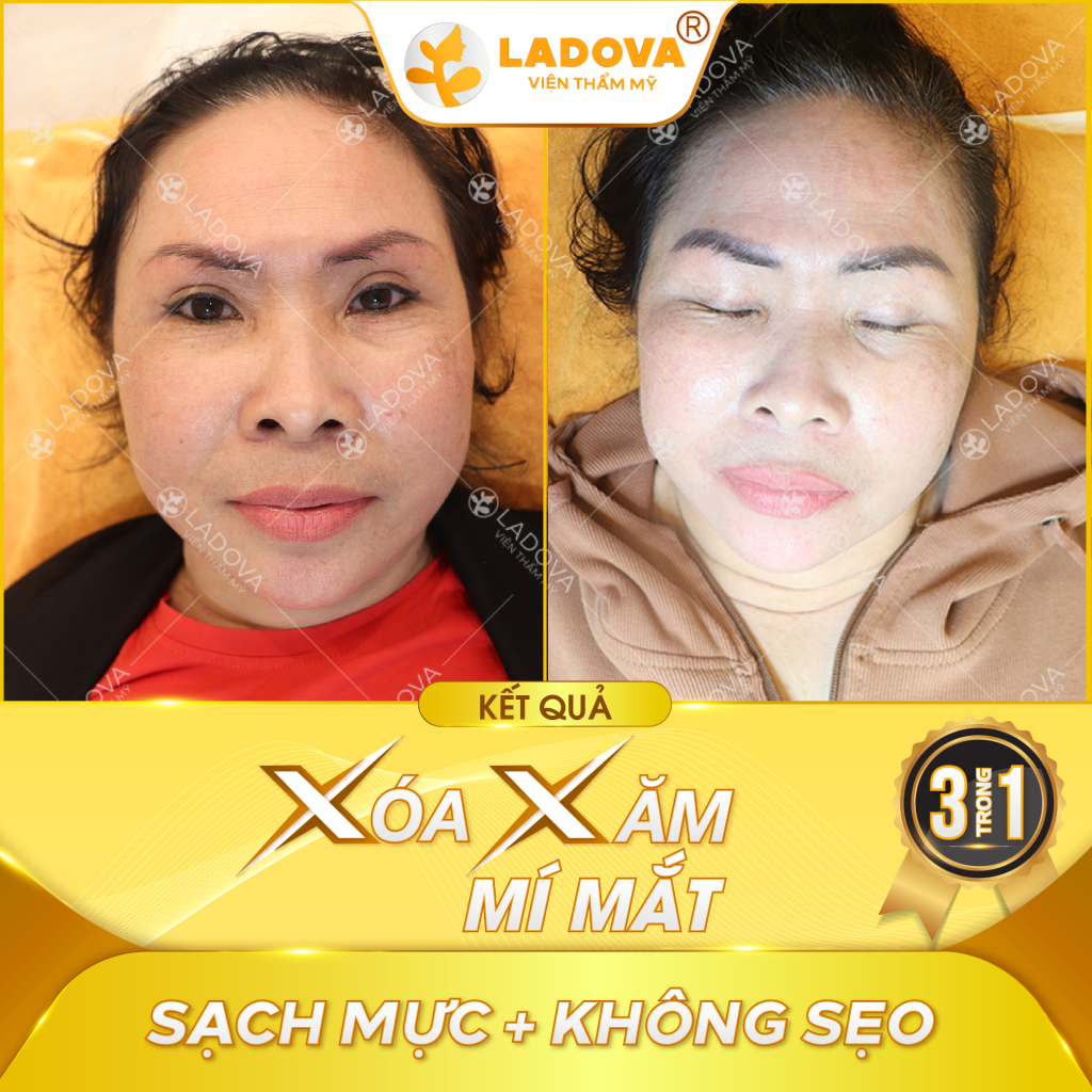 xoa-xam-mi-mat-uy-tin-01
